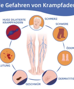 Ourlyard ™ Medizinisches VenenEase Therapie spray