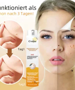 Ourlyard™ Biene Venom Wart und Tags Entfernung Behandlung Spray