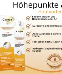 Ourlyard™ Biene Venom Wart und Tags Entfernung Behandlung Spray