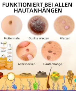 Ourlyard™ Biene Venom Wart und Tags Entfernung Behandlung Spray