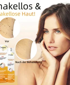 Ourlyard™ Biene Venom Wart und Tags Entfernung Behandlung Spray