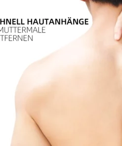 Ourlyard™ Biene Venom Wart und Tags Entfernung Behandlung Spray