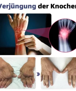 Ourlyard™ Neuseeland Bienengift Gelenk- und Knochen-Therapie Fortgeschrittene Creme