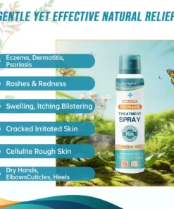 Ourlyard™ Psoriasis- und Ekzem-Naturheilmittel-Spray