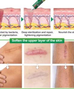 Ourlyard™ Salicylic Acid Scar Removal Gel