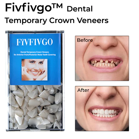 Oveallgo™ Dental Crown Veneers