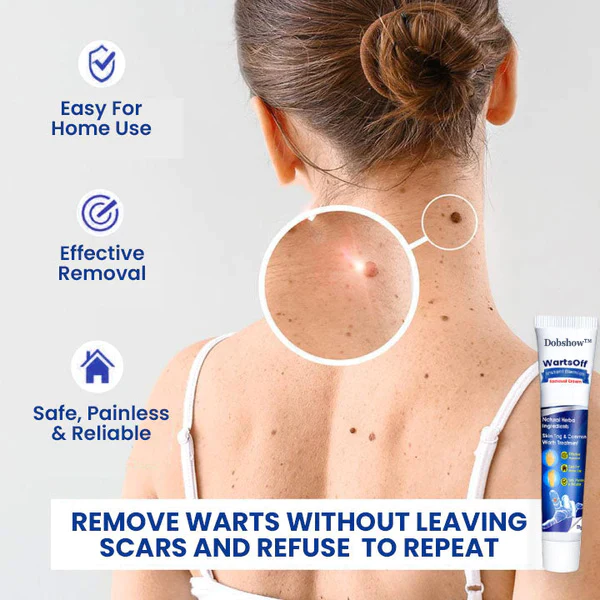 Dobshow™ WartsOff Rapid Creme zur sofortigen Entfernung von Hautunreinheiten
