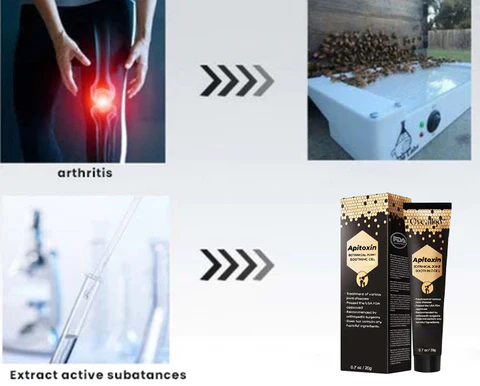 Oveallgo™ Apitoxin Natural Joint Soothing Gel