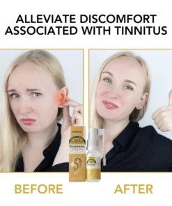 Oveallgo™ BuzzAway Propolis Tinnitus Soothing Spray