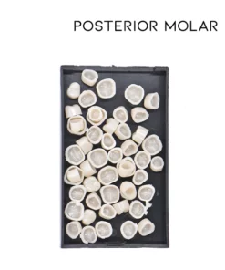 Oveallgo™ Dental Temporary Crown Veneers