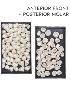 Oveallgo™ Dental Temporary Crown Veneers