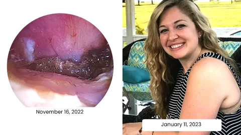 Oveallgo™ EchoPure Organic Ear Support Elixir