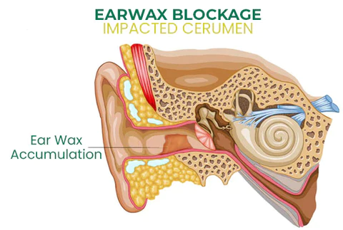 Oveallgo™ EchoPure Organic Ear Support Elixir
