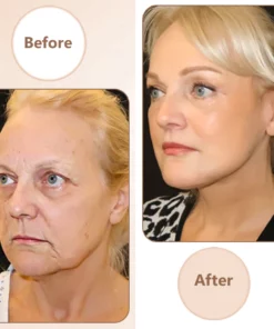 Oveallgo™ FirmLuxe Multi-Power Firming Magic Cream