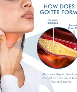 Oveallgo™ Goiterless Neck Skin Firming Serum