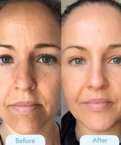 Oveallgo™ Korean Bio-Collagen Real Deep Mask