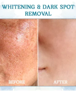 Oveallgo™ LuxeLift Skin Firming Youth Butter