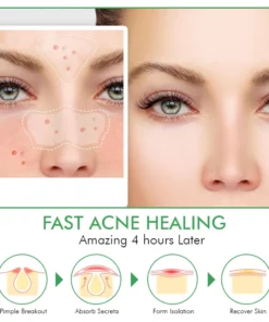 Oveallgo™ Overnight Hydrocolloid Acne Clear Patches