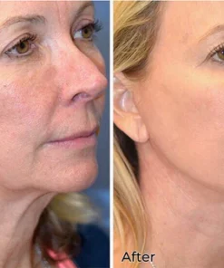 Oveallgo™ Snail Peptide Neck And Face Renewal Stick