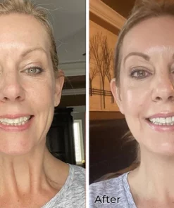 Oveallgo™ Snail Peptide Neck And Face Renewal Stick