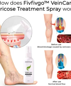 Oveallgo™ VeinCare Varicose Treatment Spray