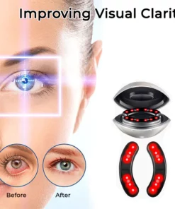 Oveallgo™ VisionPro Microcurrent Heated Ocular Vitality Device