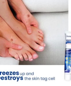 Dobshow™ WartsOff Rapid Creme zur sofortigen Entfernung von Hautunreinheiten