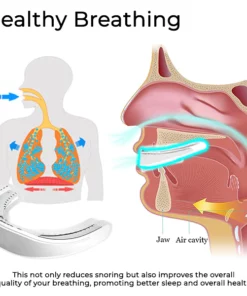 Oveallgo™ WellSleep Apnea Oral Appliances