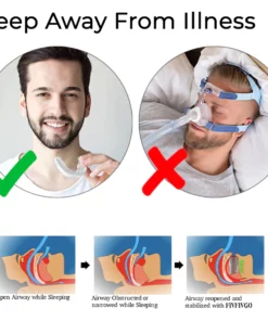 Oveallgo™ WellSleep Apnea Oral Appliances
