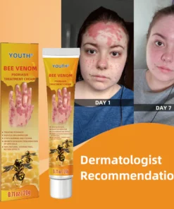 PeakFlow® Bee Venom Psoriasis Treatment Cream