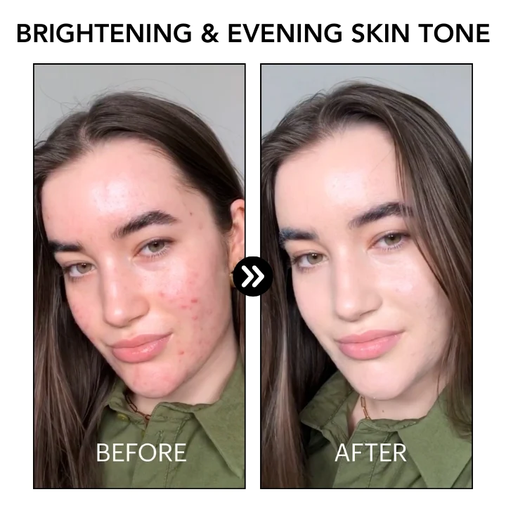Oveallgo™ PoreClear 2% BHA Skin Renewal Liquid 