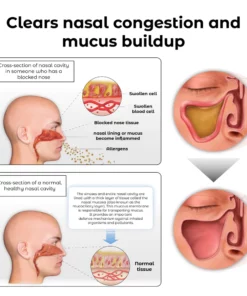 RICPIND EMS Respi weghachi ngwaọrụ ọgwụgwọ imi