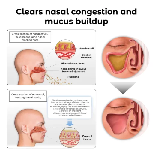 Dispositivo de terapia nasal RICPIND EMS RespiRestore