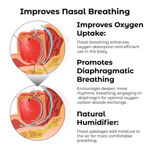 Dispositivo de terapia nasal RICPIND EMS RespiRestore