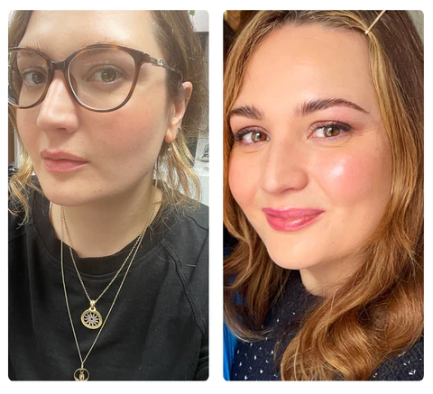 RICPIND Sight Renew Electric Ocular Vitality Device