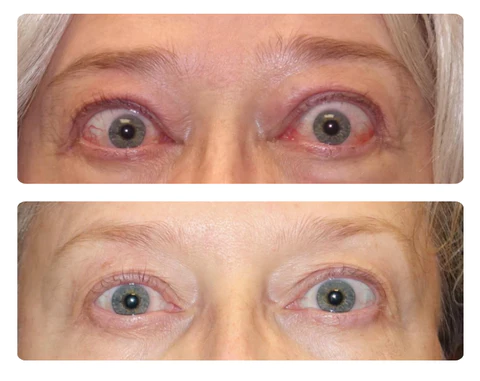 RICPIND Sight Renew Electric Ocular Vitality Device