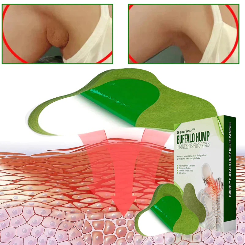 Seurico™ flasteri za limfnu drenažu