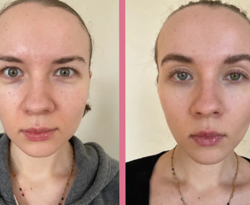 Seurico™ Facial Massager - Red Light Therapy Facial Sculpting & Facial Contouring Device