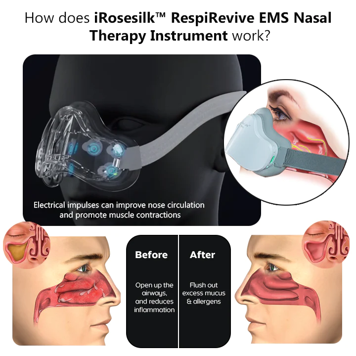 Fivfivgo™ RespiRevive EMS Nasaltherapie-Instrument