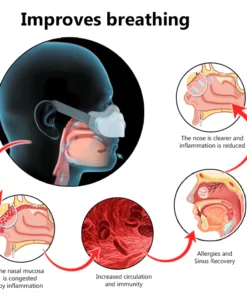 Fivfivgo™ RespiRevive EMS Nasaltherapie-Instrument
