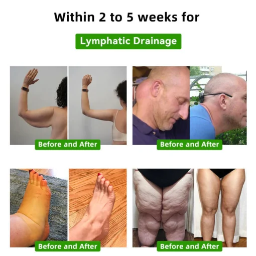 ™ 𝗮𝗴𝗲 𝗦𝗹𝗶𝗺𝗺𝗶𝗻𝗴 𝗙𝗼𝗼𝘁 𝗣𝗮𝘁𝗰𝗵
