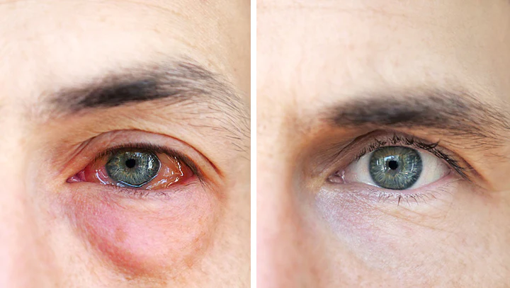 Ceoerty™ EyeRelax Patches