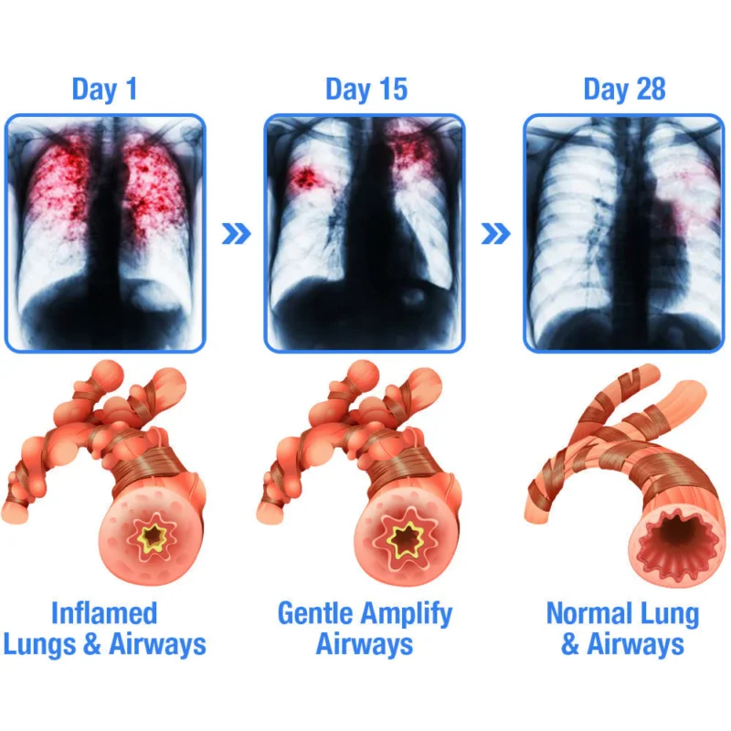 GFOUK™ BreathBliss Respiratory Cleansing Herbal Spray
