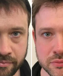 DewyEye™ Caffeine Depuffing Eye Gel