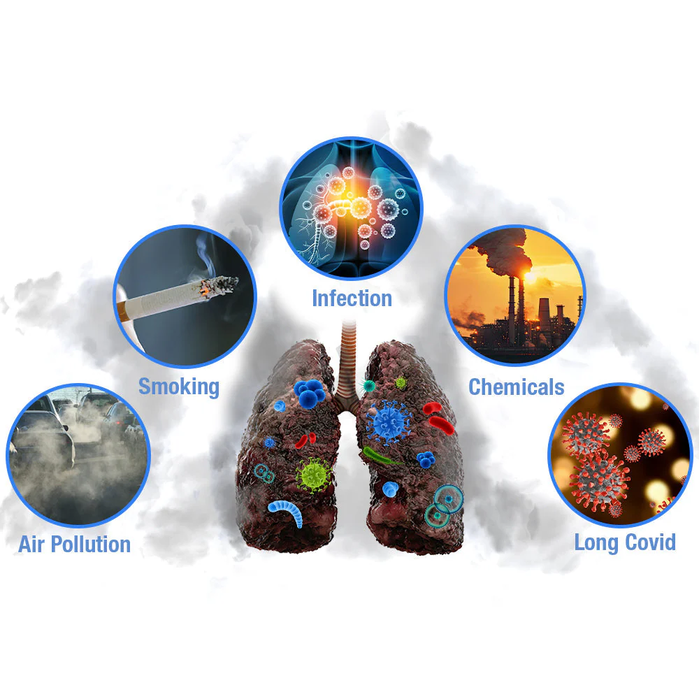 GFOUK™ BreathBliss Respiratory Cleansing Herbal Spray