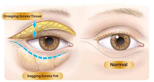 ADALINE™ Instant Lift Eye Cream - Solve Eye Skin Problems 