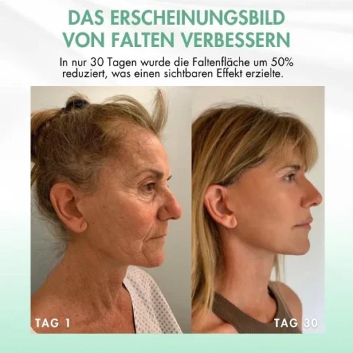مصل AEXZR™ Fortschrittliches Kollagen المضاد للشيخوخة