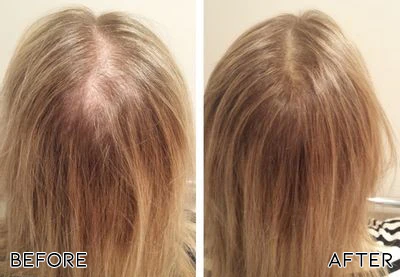 AEXZR™ Root Renew Nourishing Hair Scrub 