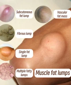 AQA™ Lipoma Soothing Cream