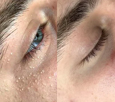Biancat™ LuminEyez Collagen Anti-Wrinkle Eye Cream